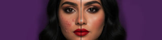 Makeup Tips for Acne-Prone Skin: What to Use and Avoid