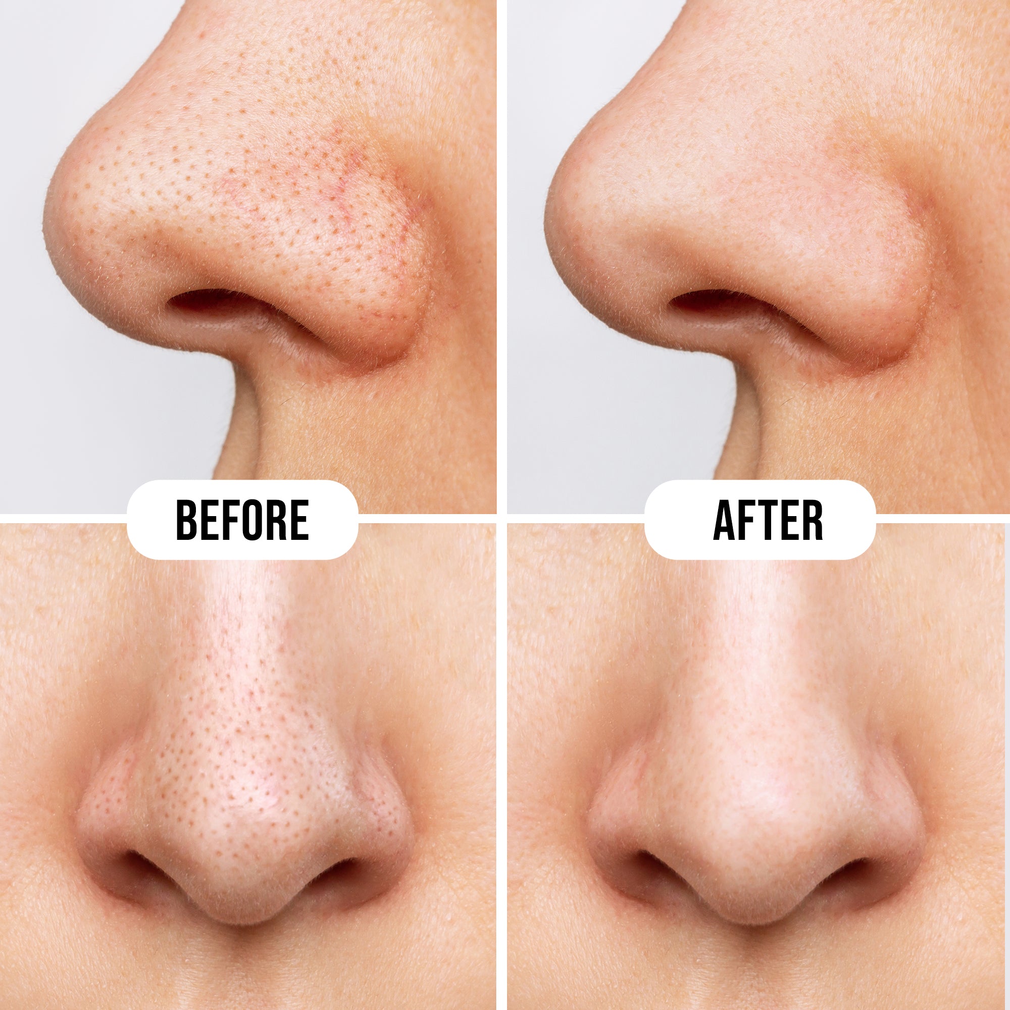 Deep Cleanse Nose Strips