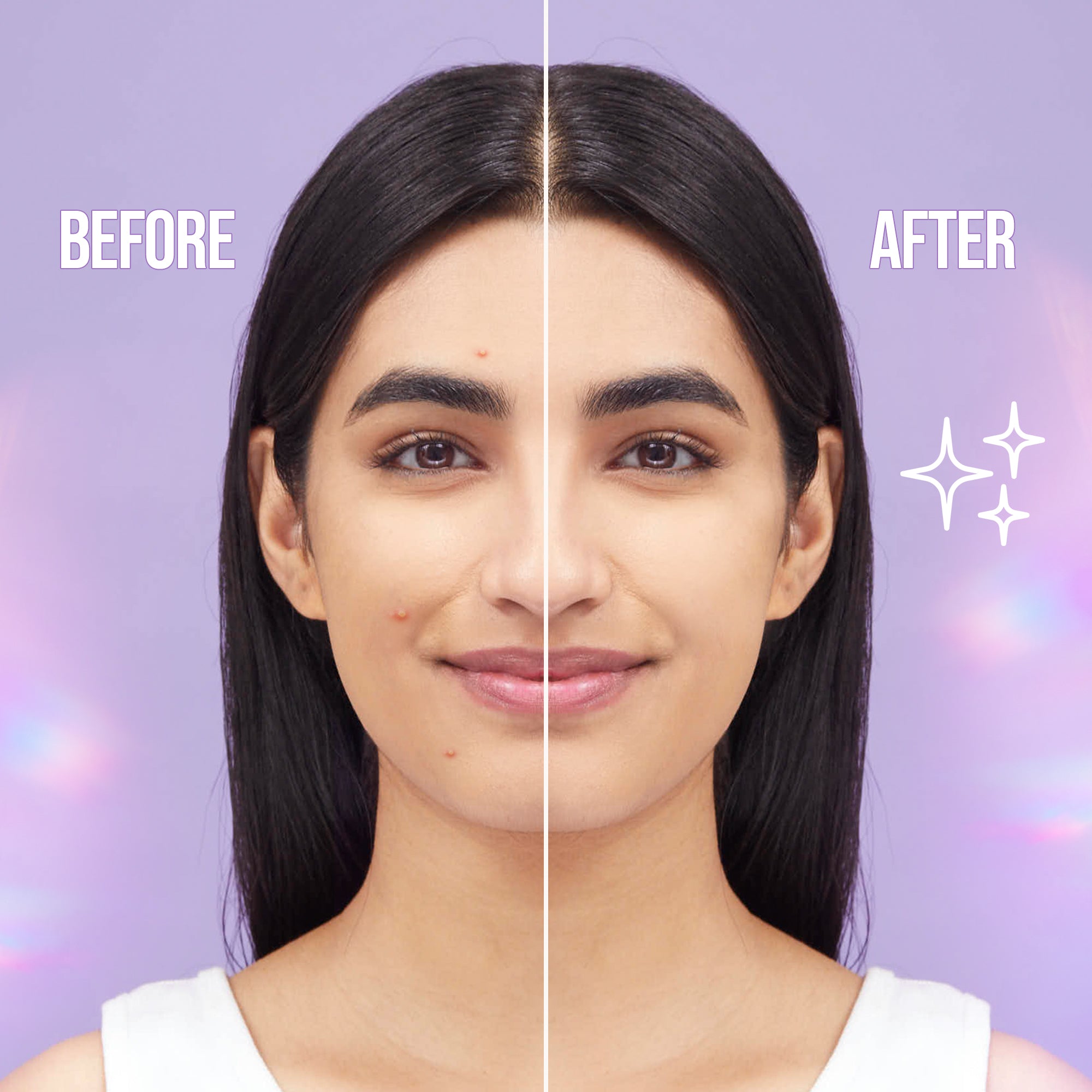Clear Skin Pimple Patch